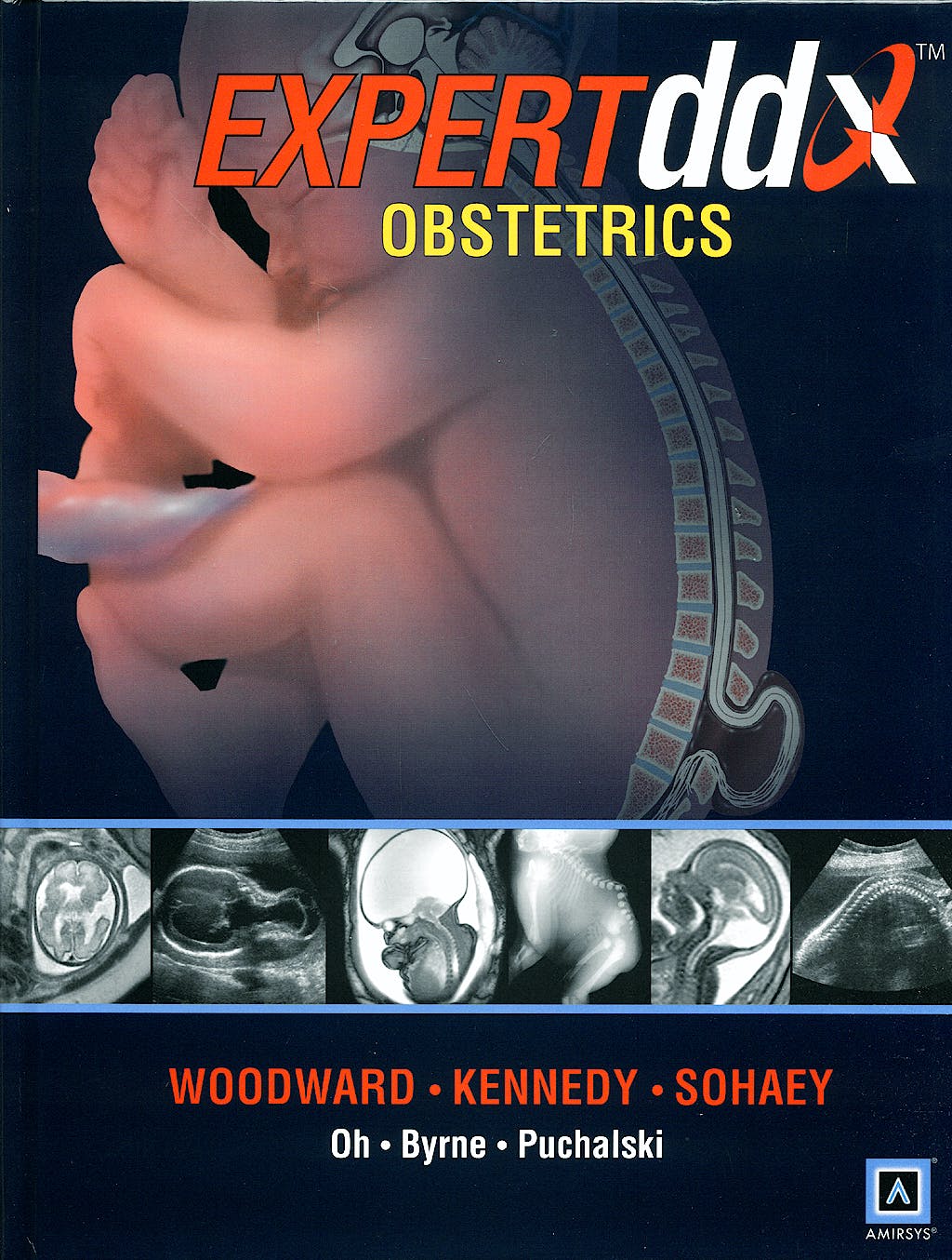 Expert ddx obstetrics