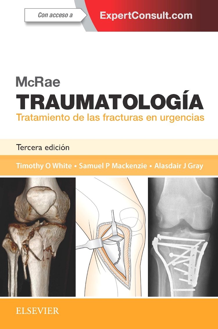 McRae Traumatología. Tratamiento de las Fracturas en Urgencias