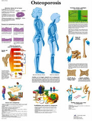 Lámina OSTEOPOROSIS