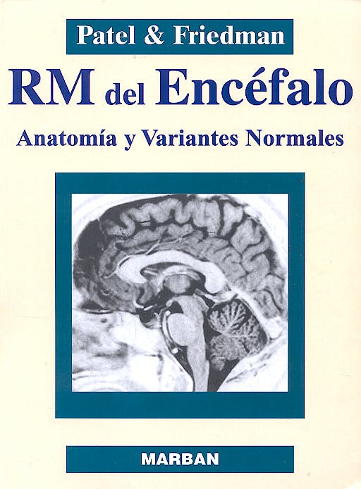 RM del Encéfalo Anatomía y Variantes Normales