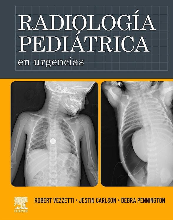 Radiología Pediátrica en Urgencias