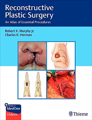 Reconstructive Plastic Surgery. An Atlas of Essential Procedures