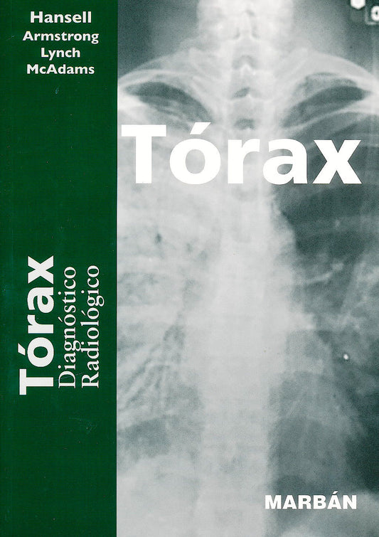 Tórax Diagnóstico Radiológico