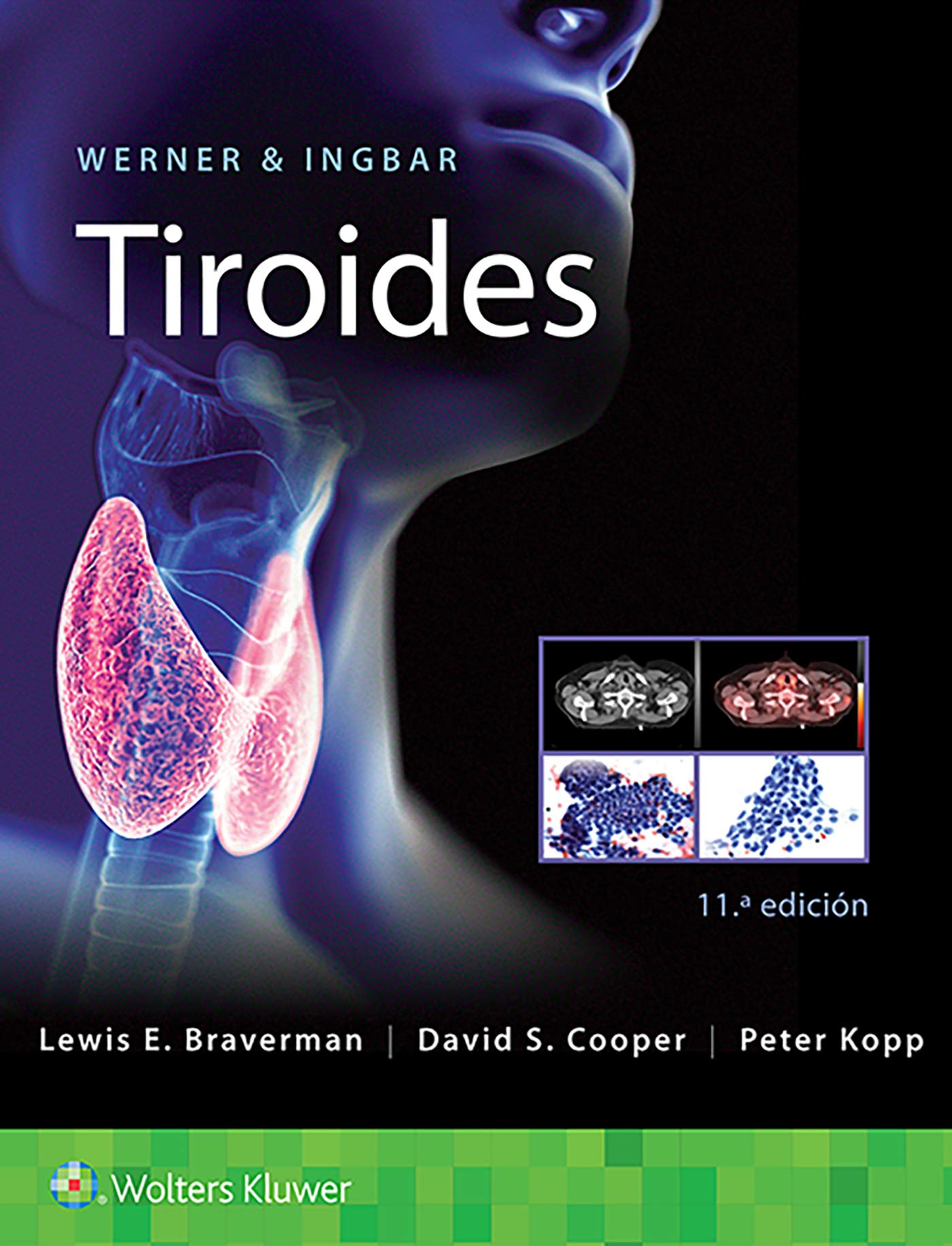 WERNER & INGBAR Tiroides