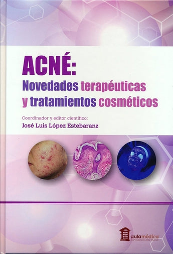 Acné: Novedades Terapéuticas y Tratamientos Cosméticos ISBN: 9788478856398 Marban Libros