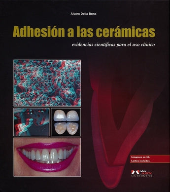Adhesión a las cerámicas ISBN: 9788536700953 Marban Libros