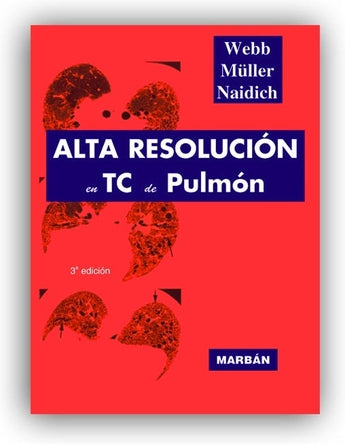 Alta Resolución en TC de Pulmón ISBN: 9788471013682 Marban Libros
