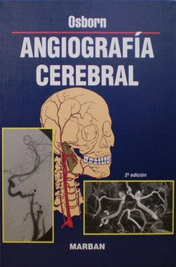 Angiografía Cerebral ISBN: 9788471012906 Marban Libros