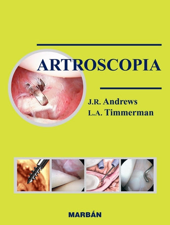 Artroscopia ISBN: 9788471013293 Marban Libros