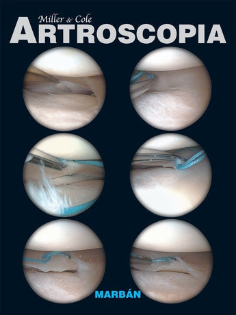 Artroscopia ISBN: 9788471017093 Marban Libros