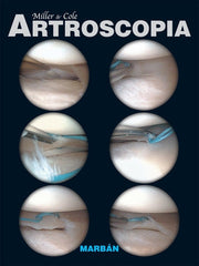 Artroscopia ISBN: 9788471017093 Marban Libros