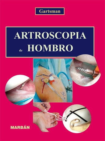 Artroscopia de Hombro ISBN: 9788471014443 Marban Libros