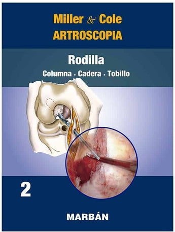 Artroscopia. Rodilla. Columna. Cadera. Tobillo Vol 2 ISBN: 9788418068553 Marban Libros