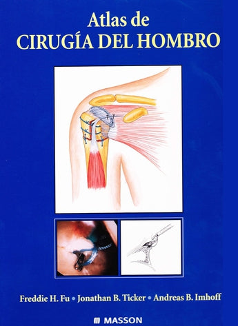 Atlas de Cirugía del Hombro ISBN: 9788445808382 Marban Libros