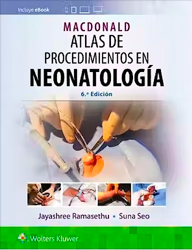 MAcDONALD Atlas de Procedimientos en Neonatología