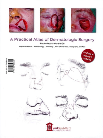 Atlas Dermatologic Surgery Vol. 2º ISBN: 9788478856435 Marban Libros