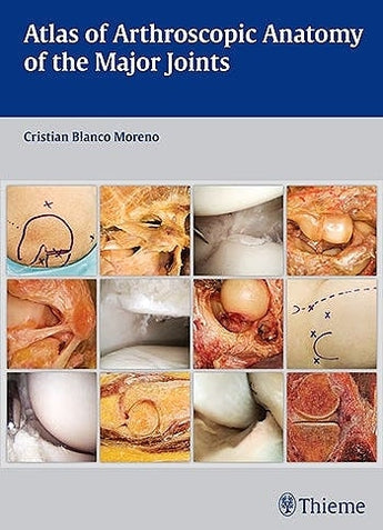 Atlas of Arthroscopic Anatomy of the Major Joints ISBN: 9783132037915 Marban Libros