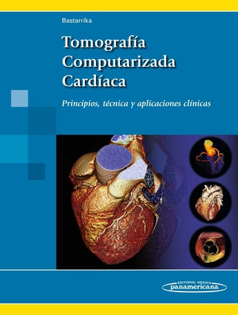 Bastarrika - Tomografía Computarizada Cardíaca. Principios, técnica y aplicaciones clínicas ISBN: Marban Libros