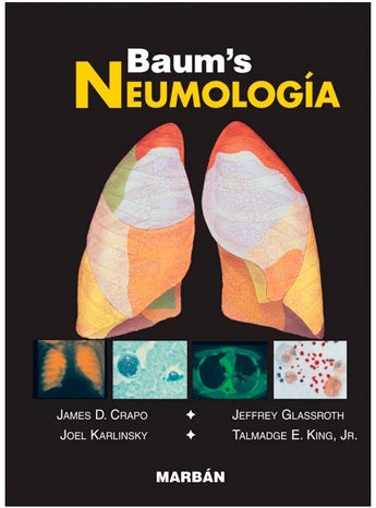 Baum / Formato "Handbook" - Neumología ISBN: Marban Libros