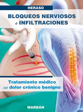 Bloqueos Nerviosos e Infiltraciones ISBN: 9788471019578 Marban Libros