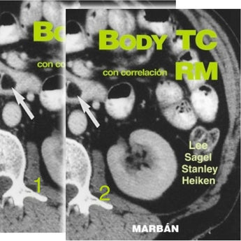 Body TC con correlación RM 2 Vols. ISBN: 9788471016072 Marban Libros