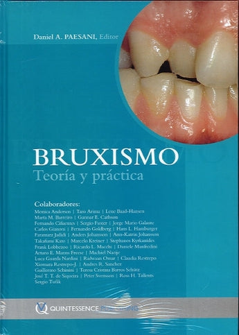 Bruxismo Teoría y Práctica ISBN: 9788489873506 Marban Libros