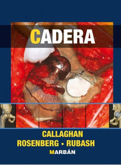 Cadera Versión 1 tomo ISBN: 9788471017925 Marban Libros