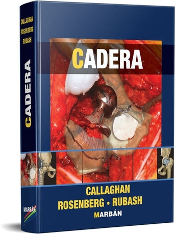 Cadera Versión 1 tomo ISBN: 9788471017925 Marban Libros