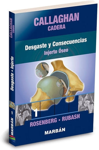 Callaghan Cadera 1: Desgaste y Consecuencias. Injerto Óseo ISBN: 9788418068423 Marban Libros