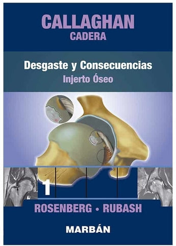 Callaghan Cadera 1: Desgaste y Consecuencias. Injerto Óseo ISBN: 9788418068423 Marban Libros