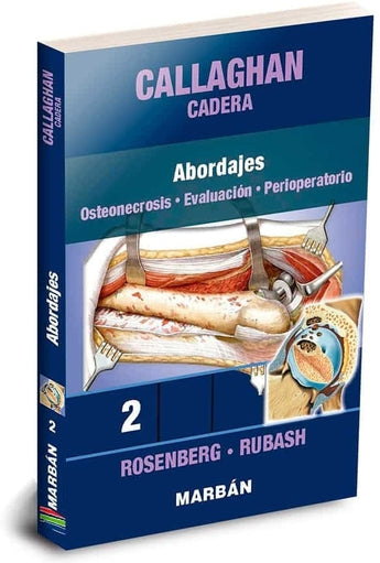 Callaghan Cadera 2: Abordajes. Osteonecrosis. Evaluación. Perioperatorio ISBN: 9788418068430 Marban Libros