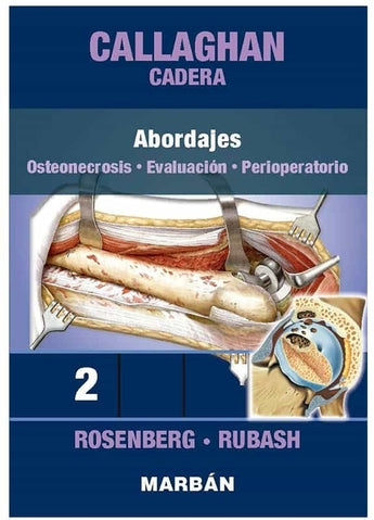 Callaghan Cadera 2: Abordajes. Osteonecrosis. Evaluación. Perioperatorio ISBN: 9788418068430 Marban Libros