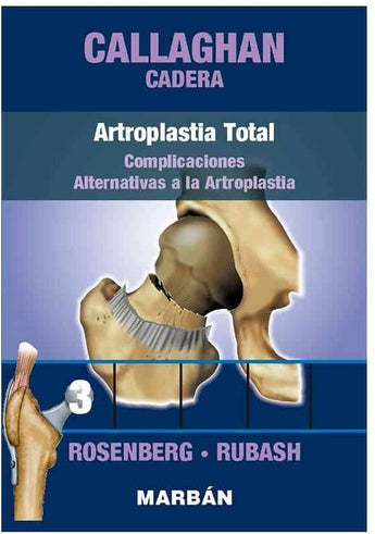 Callaghan Cadera 3. Artroplastia Total. Complicaciones. Alternativas a la Artroplastia ISBN: 9788418068447 Marban Libros