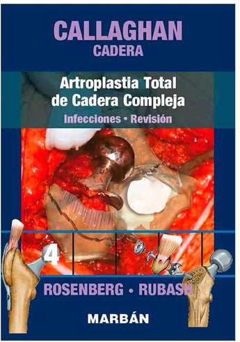 Callaghan Cadera 4. Artroplastia Total de Cadera Compleja. Infecciones. Revisión ISBN: 9788418068454 Marban Libros