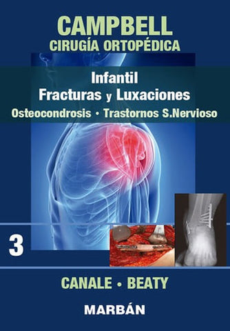 Campbell Cirugía Ortopédica. Tomo 3 -Infantil, Fracturas y Luxaciones, Osteocondrosis, Trastornos S.Nervioso. ISBN: 9788471010919 Marban Libros