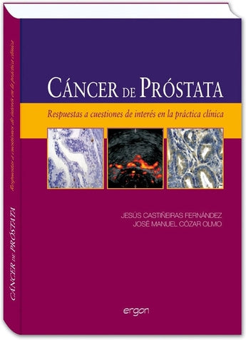 Cáncer de próstata ISBN: 9788415351375 Marban Libros