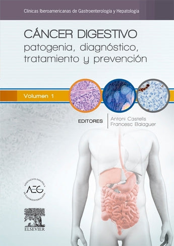 Castells . Balaguer - Cáncer digestivo: patogenia, diagnóstico, tratamiento y prevención ISBN: Marban Libros