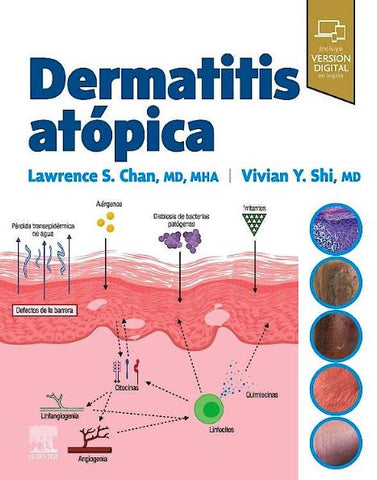 Dermatitis Atópica