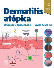 Dermatitis Atópica