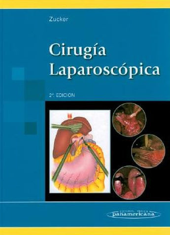Cirugía Laparoscópica ISBN: 9788479037116 Marban Libros