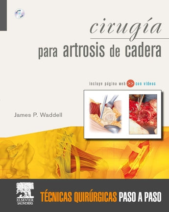 Cirugía para Artrosis de Cadera ISBN: 9788480864688 Marban Libros