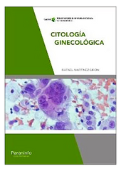 Citología Ginecológica