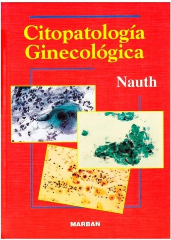 Citopatología Ginecológica ISBN: 9788471012170 Marban Libros