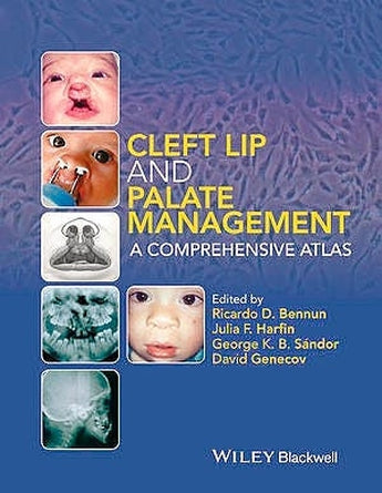Cleft Lip and Palate Management: A Comprehensive Atlas ISBN: 9781118607541 Marban Libros