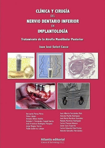 Clínica y Cirugía del Nervio Dentario Inferior en Implantología. ISBN: 9788494559051 Marban Libros