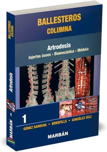 Columna Tomo 1: Artrodesis ISBN: 9788418068478 Marban Libros