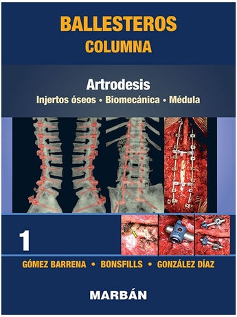 Columna Tomo 1: Artrodesis ISBN: 9788418068478 Marban Libros