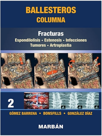 Columna Tomo 2: Fracturas ISBN: 9788418068485 Marban Libros