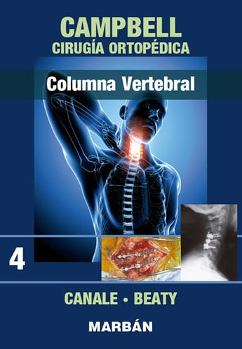 Columna Vertebral - Campbell Cirugía Ortopédica. Tomo 4 ISBN: 9788471011015 Marban Libros