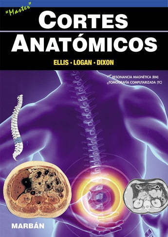 Cortes Anatómicos ISBN: 9788471018205 Marban Libros